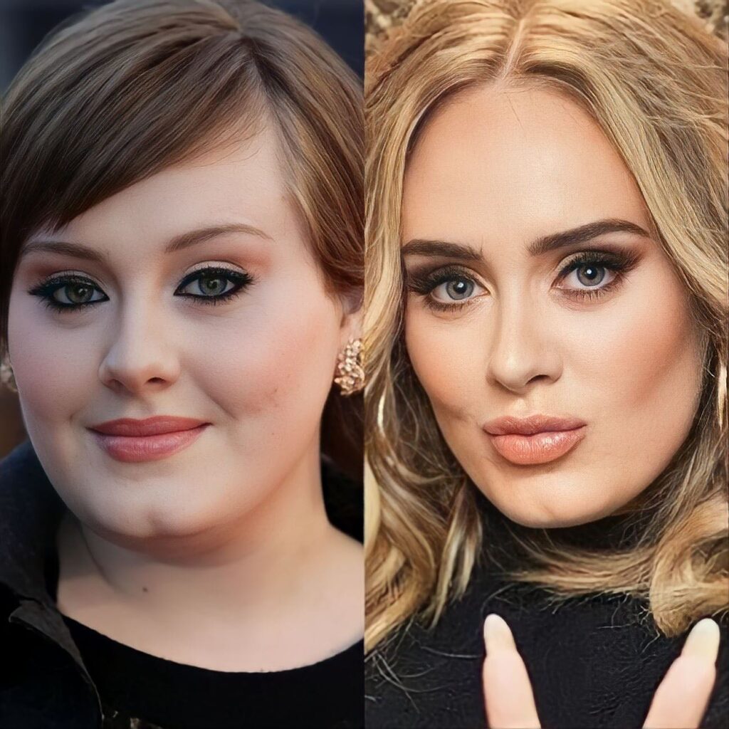 Adele weight loss journey